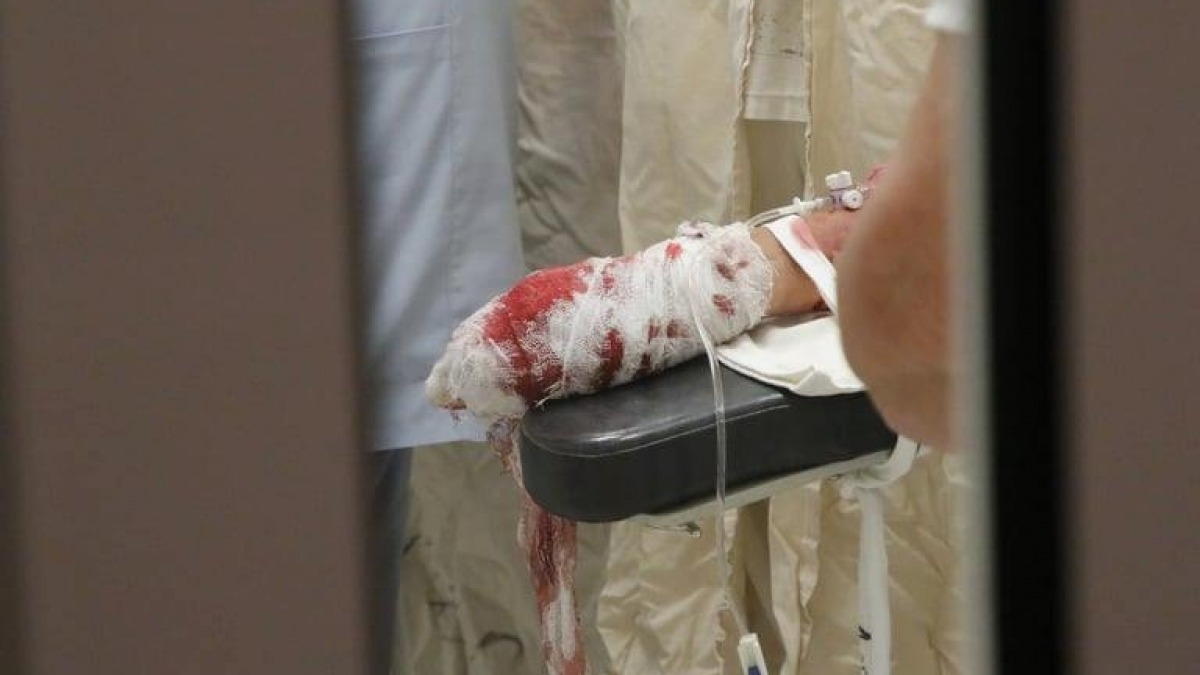 На детской площадке в Днепропетровской области взорвалась граната - пострадало 3 детей