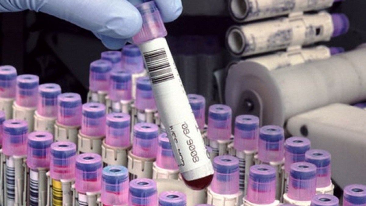 В Украину поступила первая партия бесплатных лекарств от рака