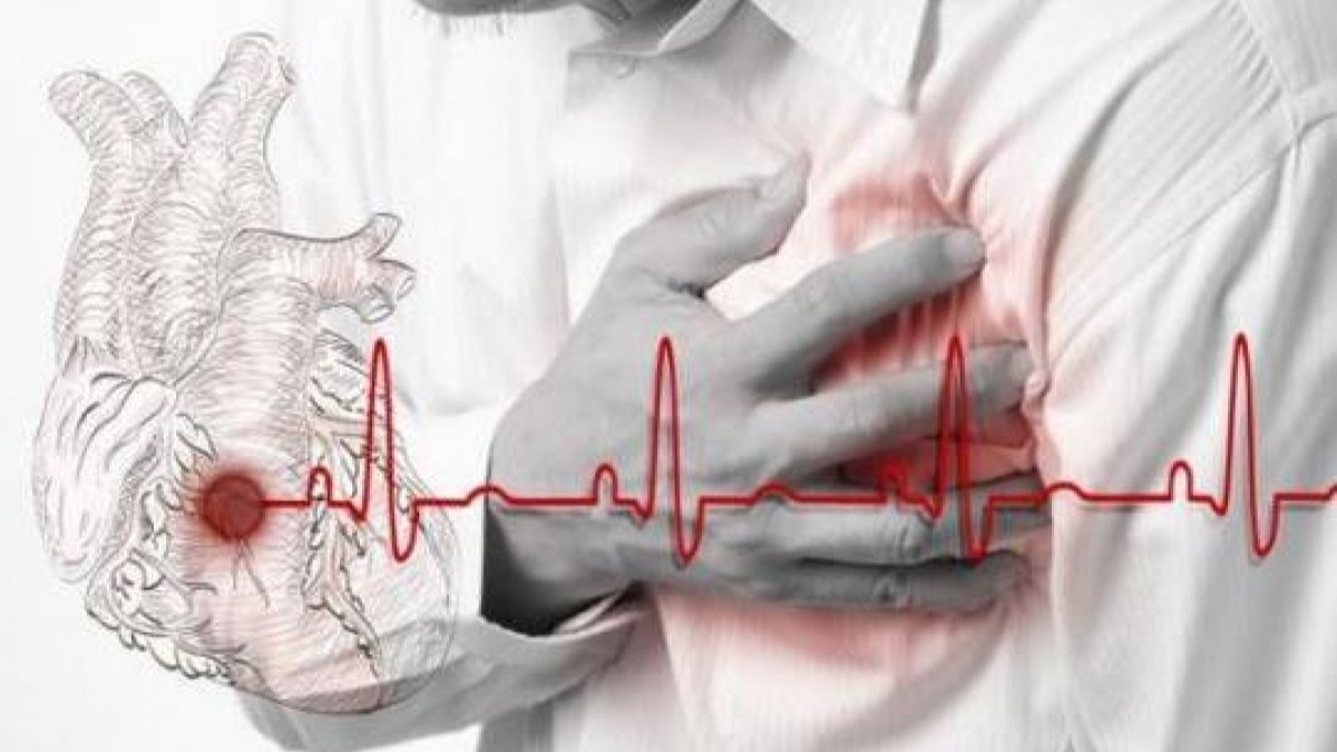 Как распознать инфаркт - советы врачей