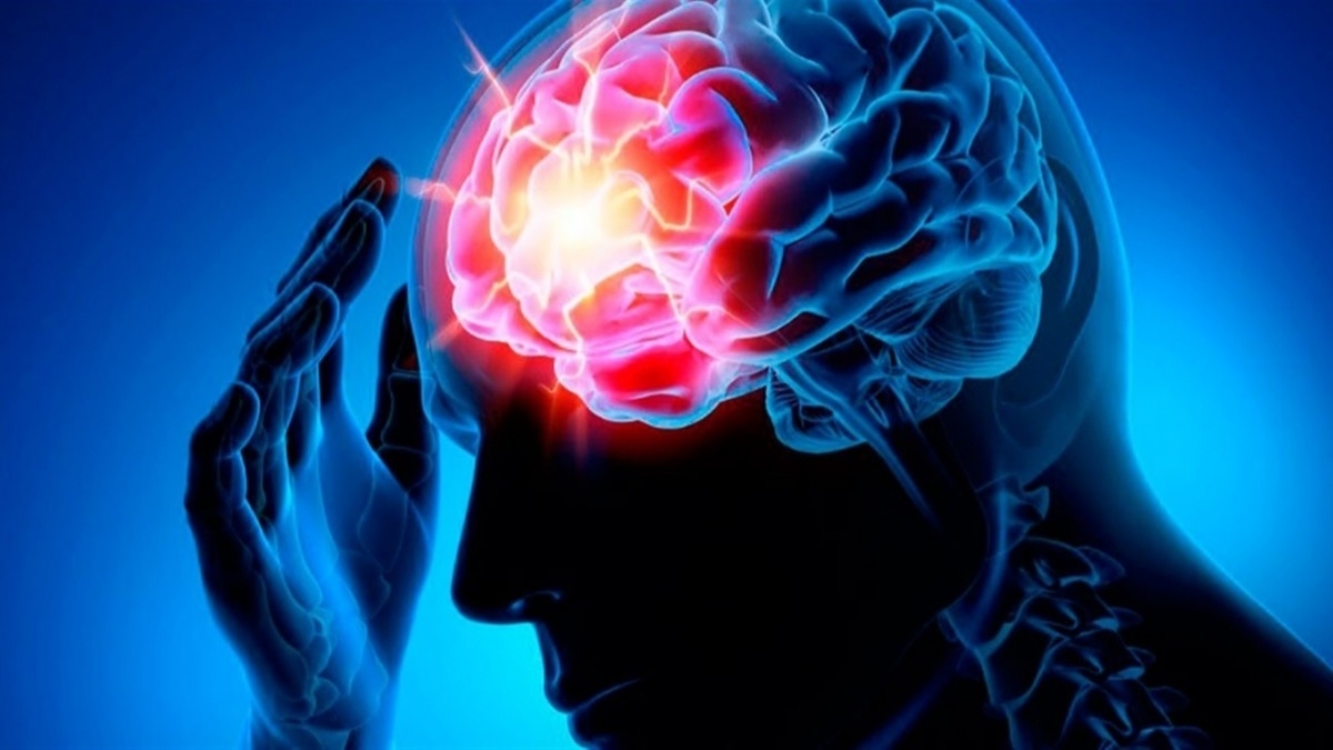 Как предупредить и распознать инсульт: советы врача