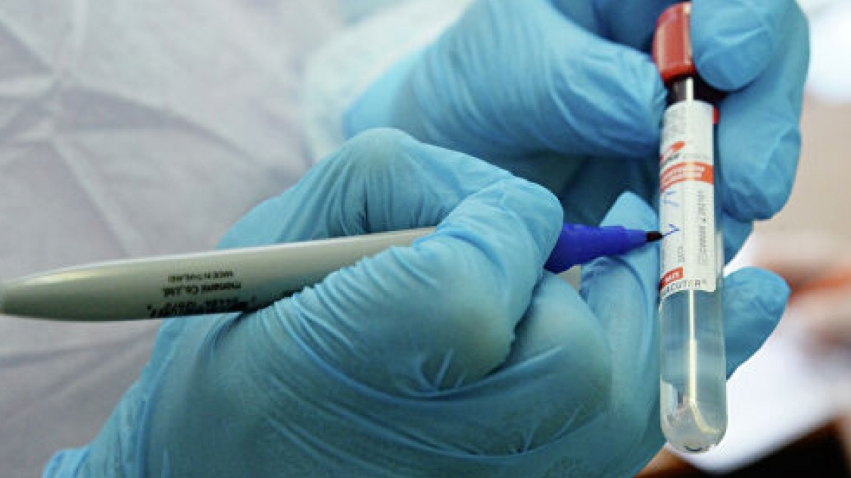 В Украине зафиксировано 2203 случаи COVID-19