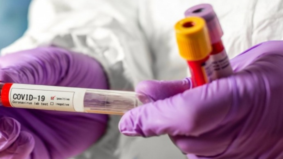 В Украине зафиксировано 9009 случаев COVID-19