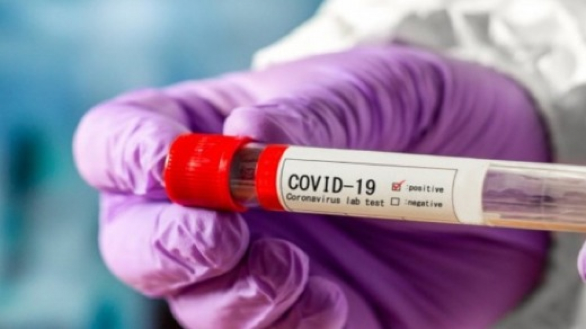 Еще у двух жителей Петропавловского района обнаружили коронавирус