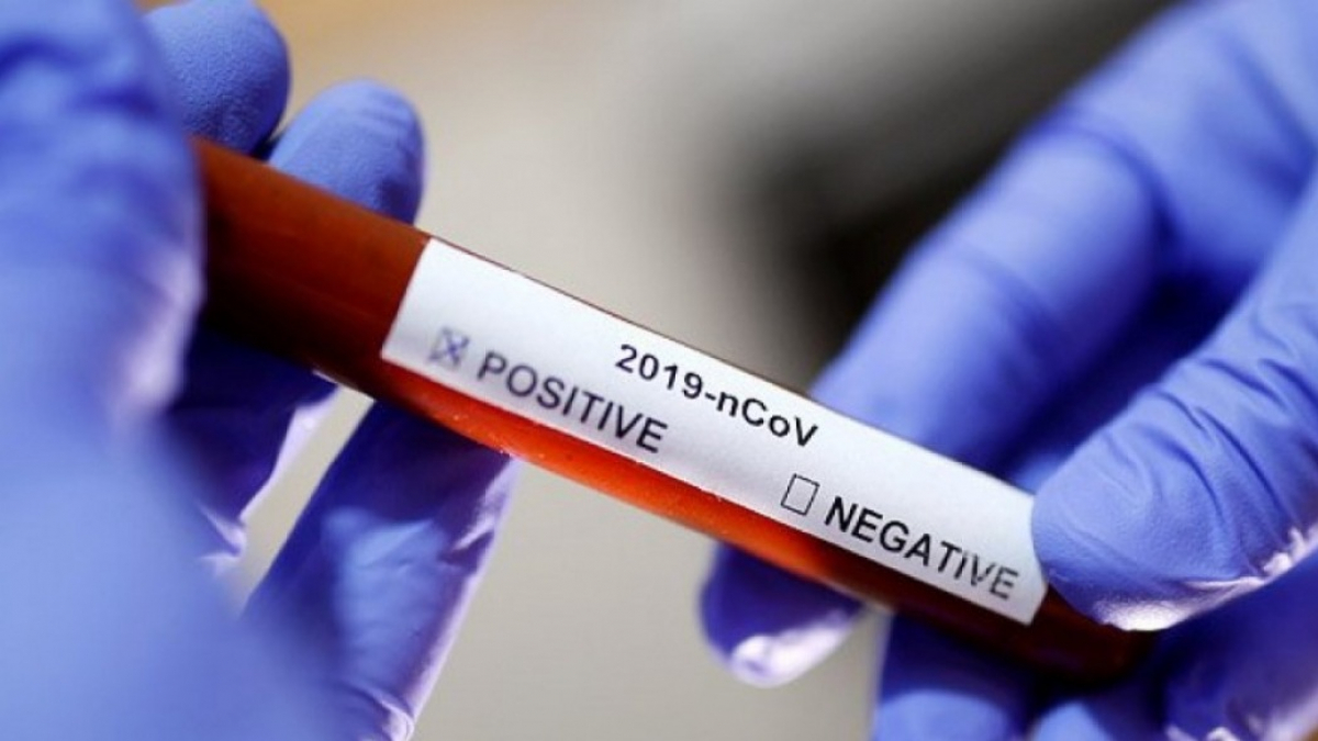 Пик заболеваемости на коронавирус прогнозируют на середину мая