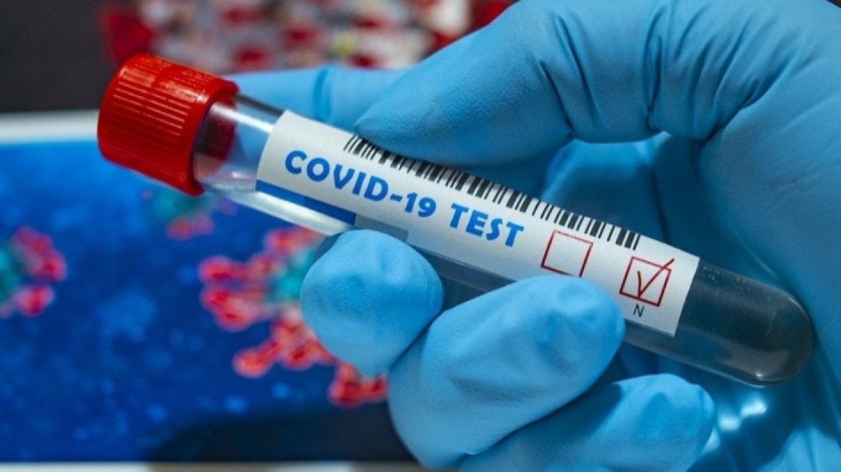 В Днепропетровской области обнаружили 30 новых случаев коронавирус