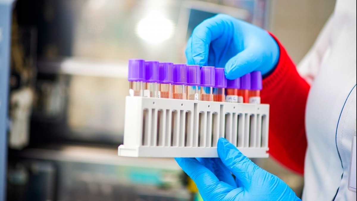 Коронавирусной инфекцией заболели еще 67 жителей Днепропетровщины