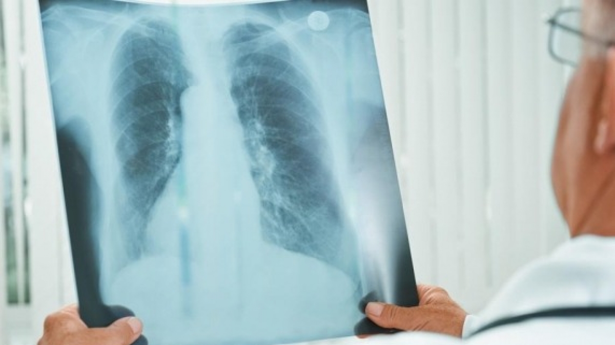 В Павлограде будут судить врача за неточный диагноз больному