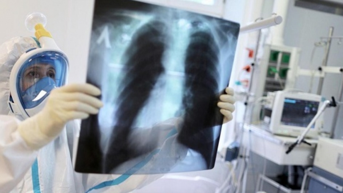 За время пандемии коронавируса в Павлограде умерло 7 жителей