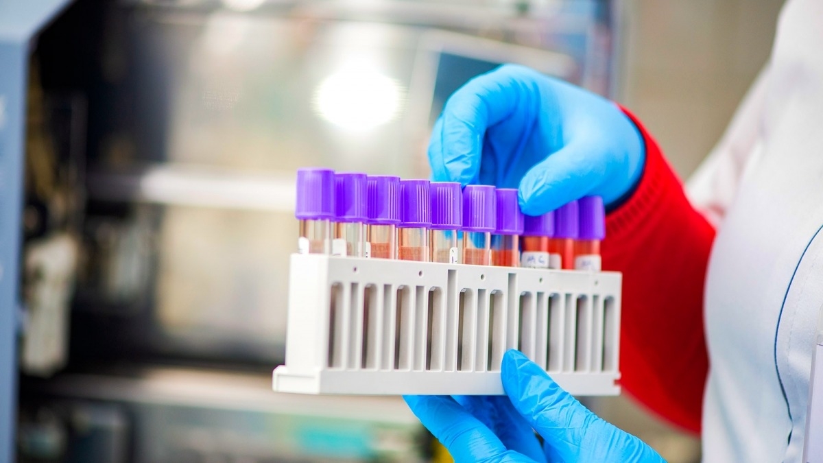 За сутки в Днепропетровской области обнаружили 231 случай коронавируса