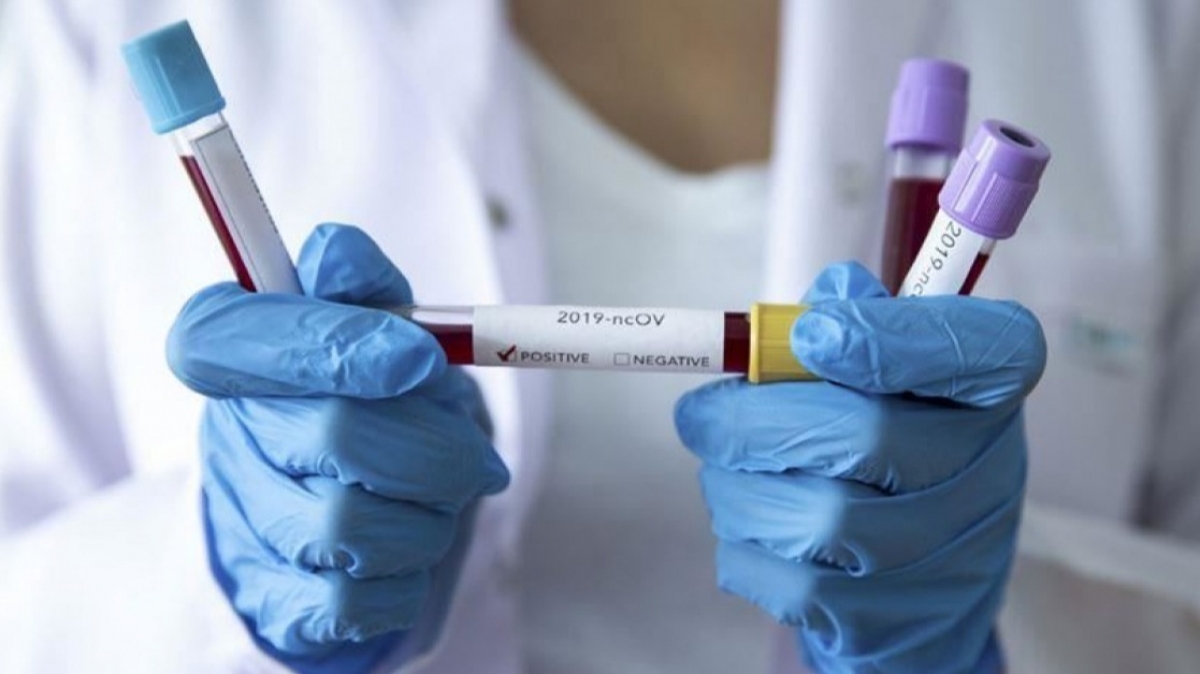 На Днепропетровщине зарегистрировали 145 новых случаев COVID-19