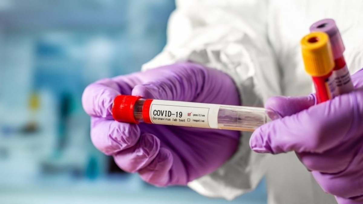 На Днепропетровщине обнаружили 426 новых случаев COVID-19