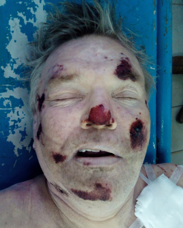 В Павлограде полиция устанавливает личность мужчины, погибшего в ДТП на Полтавской