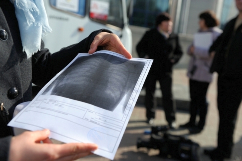 Жителей Павлоградского района бесплатно обследуют в передвижных флюорографах