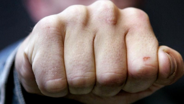 Избитый на общественном собрании павлоградец обратился в прокуратуру